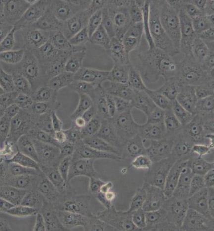 MARC145](非洲绿猴胚胎肾细胞)的应用