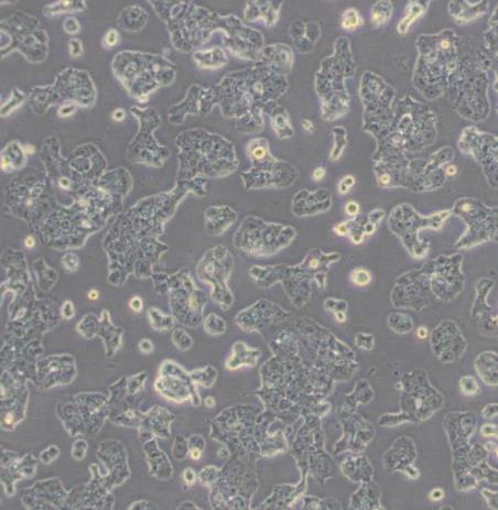 小鼠胰岛Β细胞.png