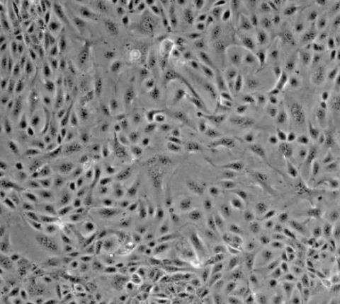 TCMK-1 小鼠肾小管上皮细胞系.png