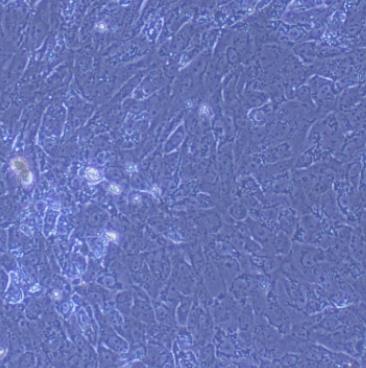 Rat Endometrial Epithelial Cells.png