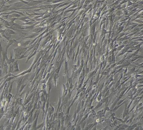 Umbilical Artery Smooth Muscle Cells（脐动脉平滑肌细胞）.png