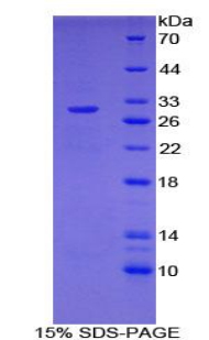 107kDa核孔蛋白(NUP107)重组蛋白