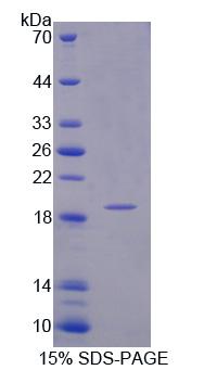 107kDa肌醇多聚磷酸-4-磷酸酶Ⅰ型(INPP4A)重组蛋白