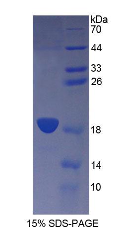 CD164分子(CD164)重组蛋白