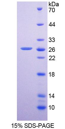 二肽基肽酶6(DPP6)重组蛋白