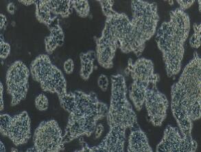小鼠胰岛素瘤胰岛β细胞；Beta-TC-6
