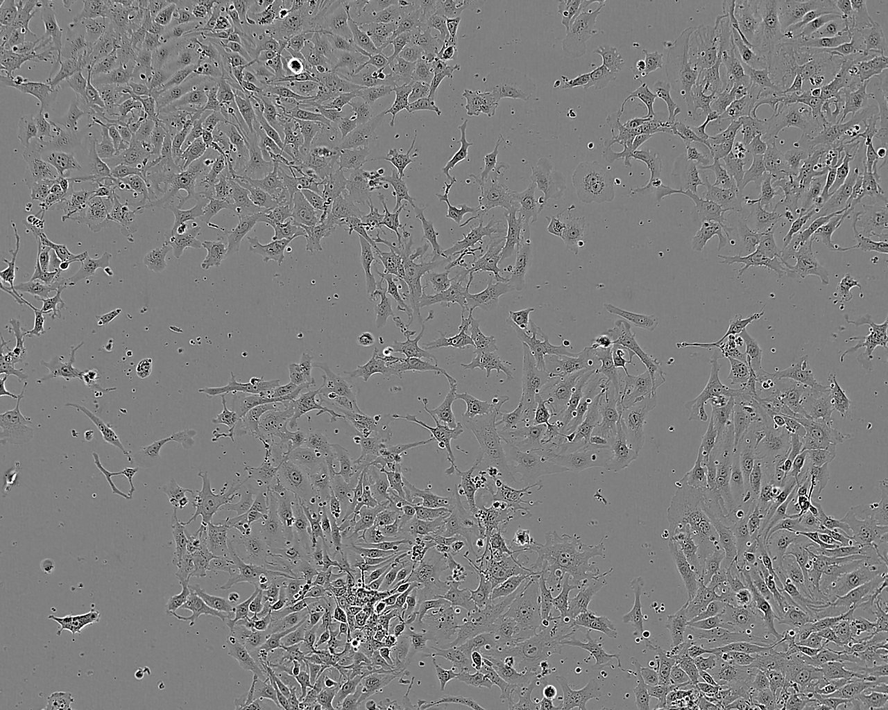 MCA-205 Cell:小鼠纤维肉瘤细胞系