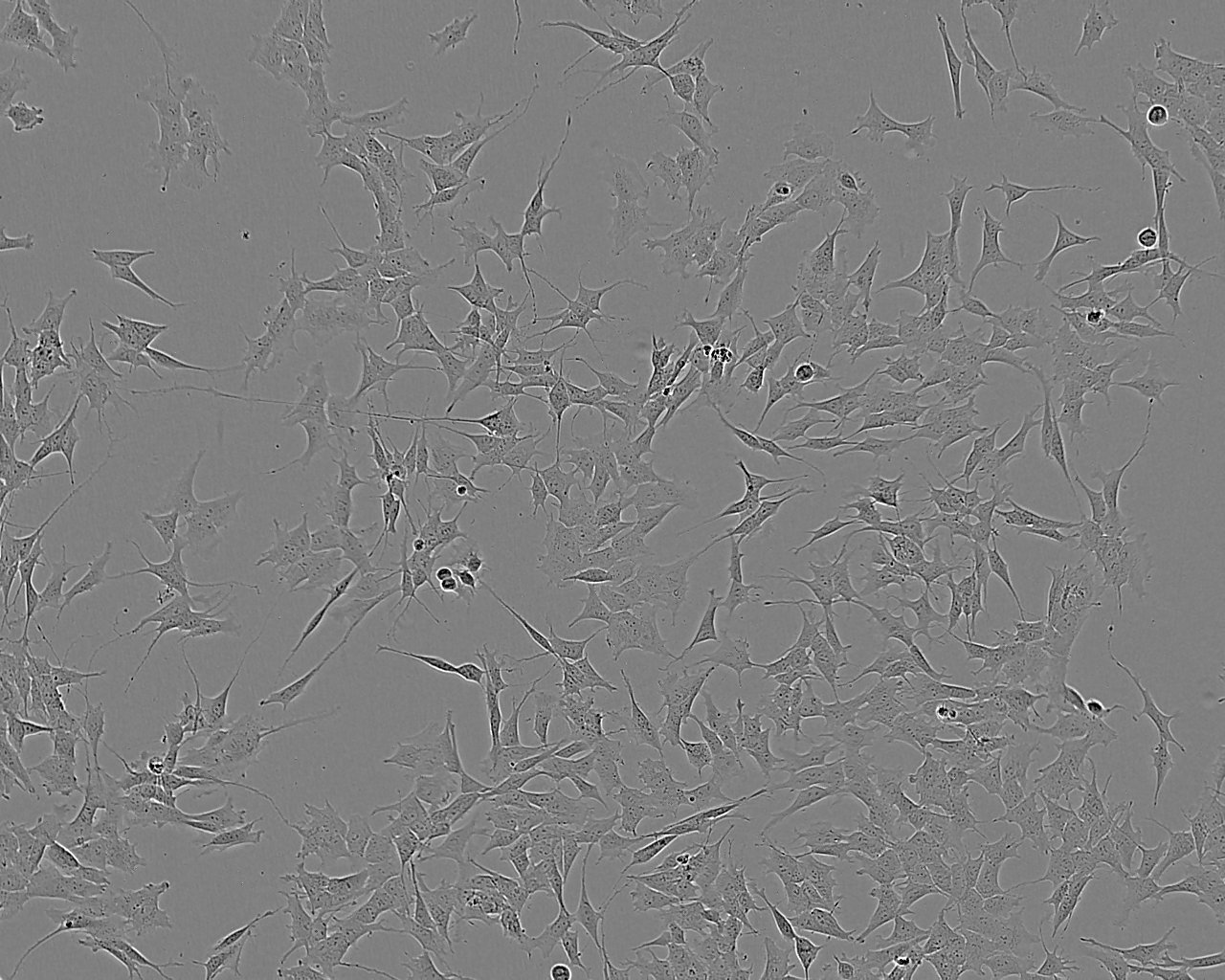 CCD-841CoN epithelioid cells人正常结肠上皮细胞系