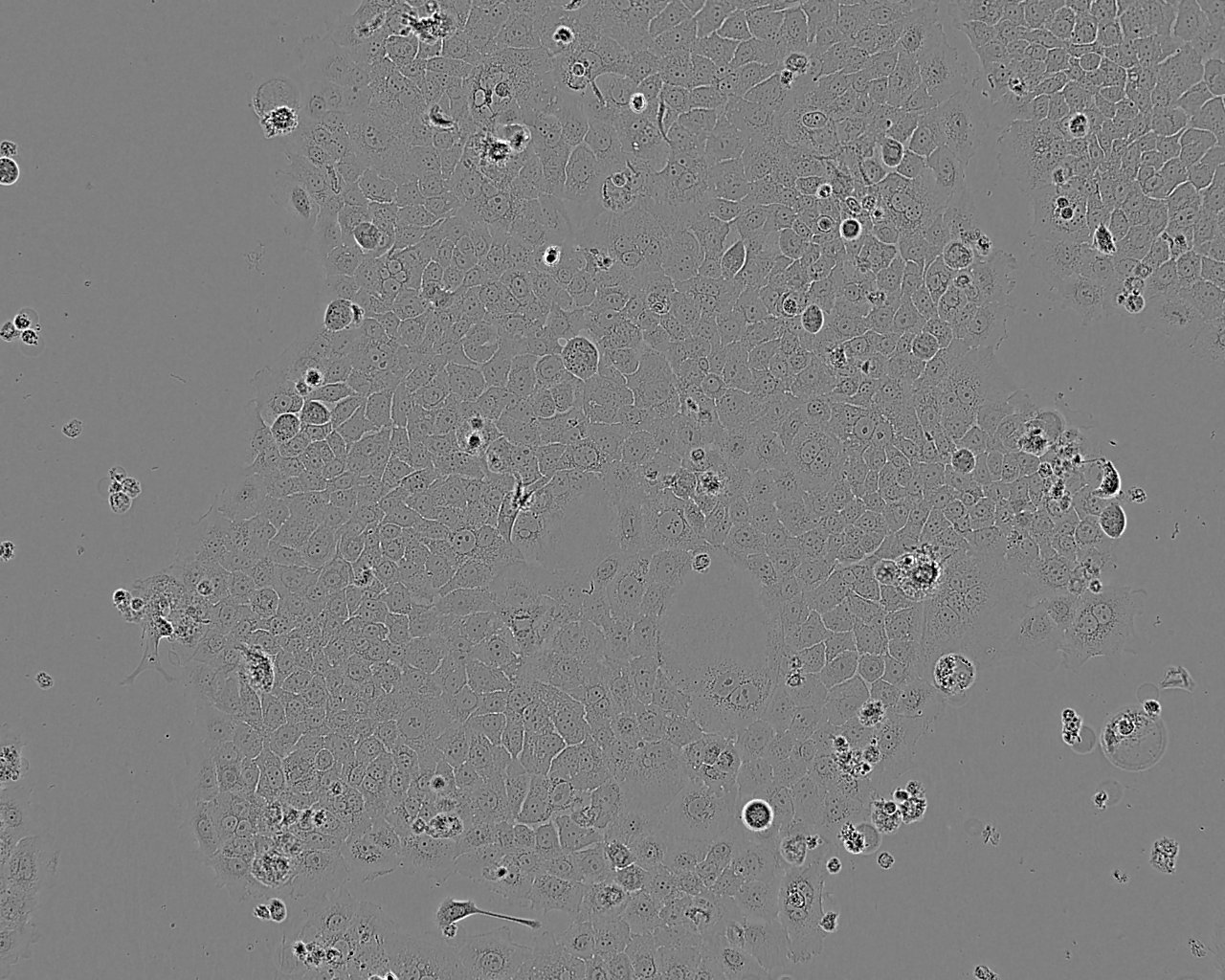 AN3-CA细胞：人子宫内膜腺癌细胞系