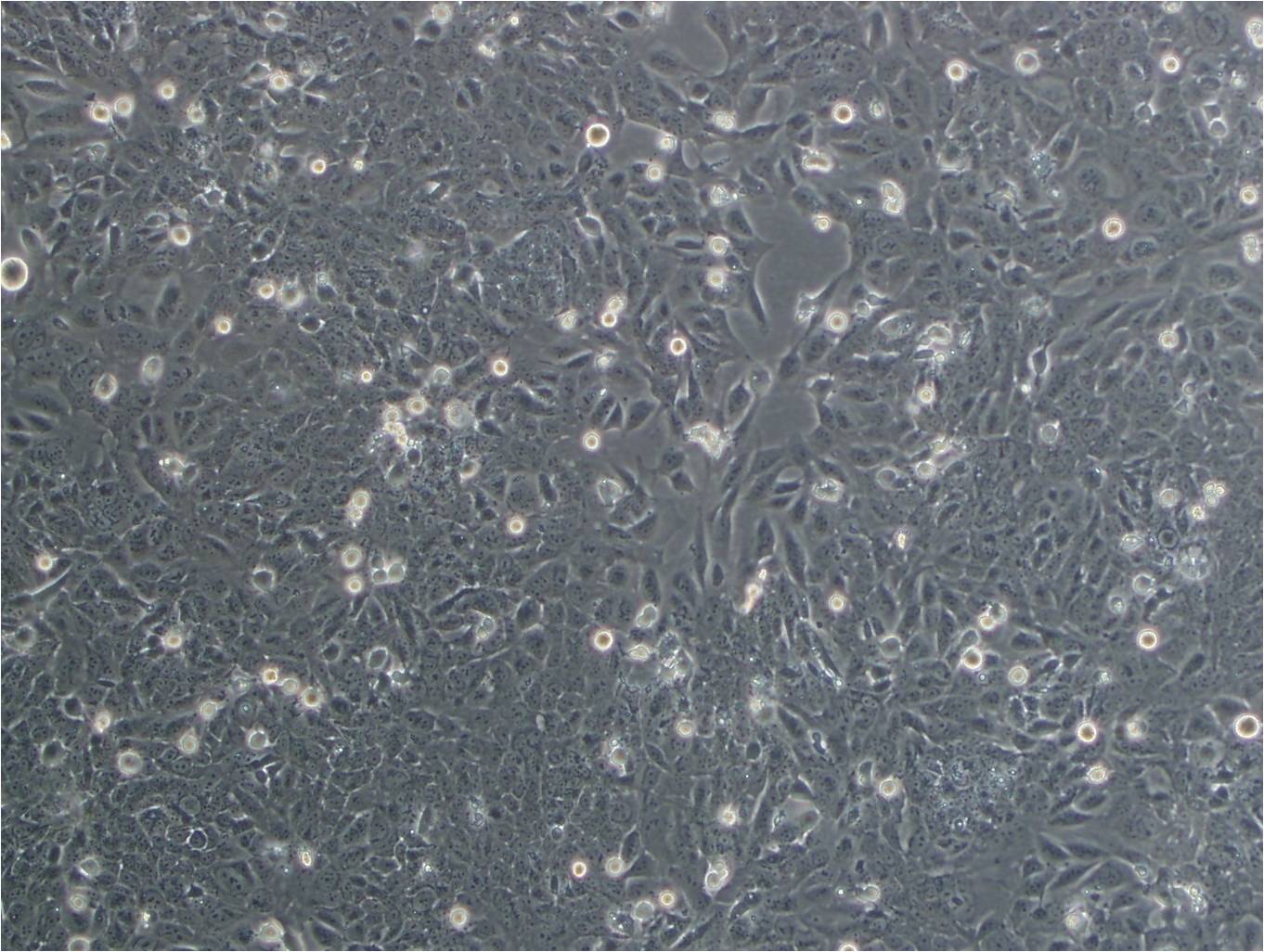 Caov-3细胞：人卵巢癌细胞系