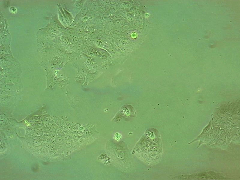 MLTC-1细胞：小鼠睾丸间质细胞瘤细胞系