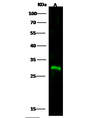 ANTI-CTLA4抗体