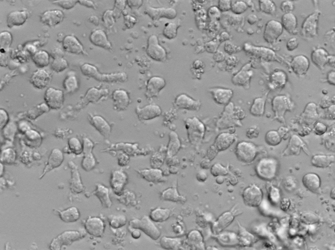 MT-4人急性淋巴母细胞白血病复苏细胞(附STR鉴定报告)