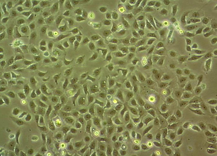 KYSE-150 Cell|人食管鳞癌细胞