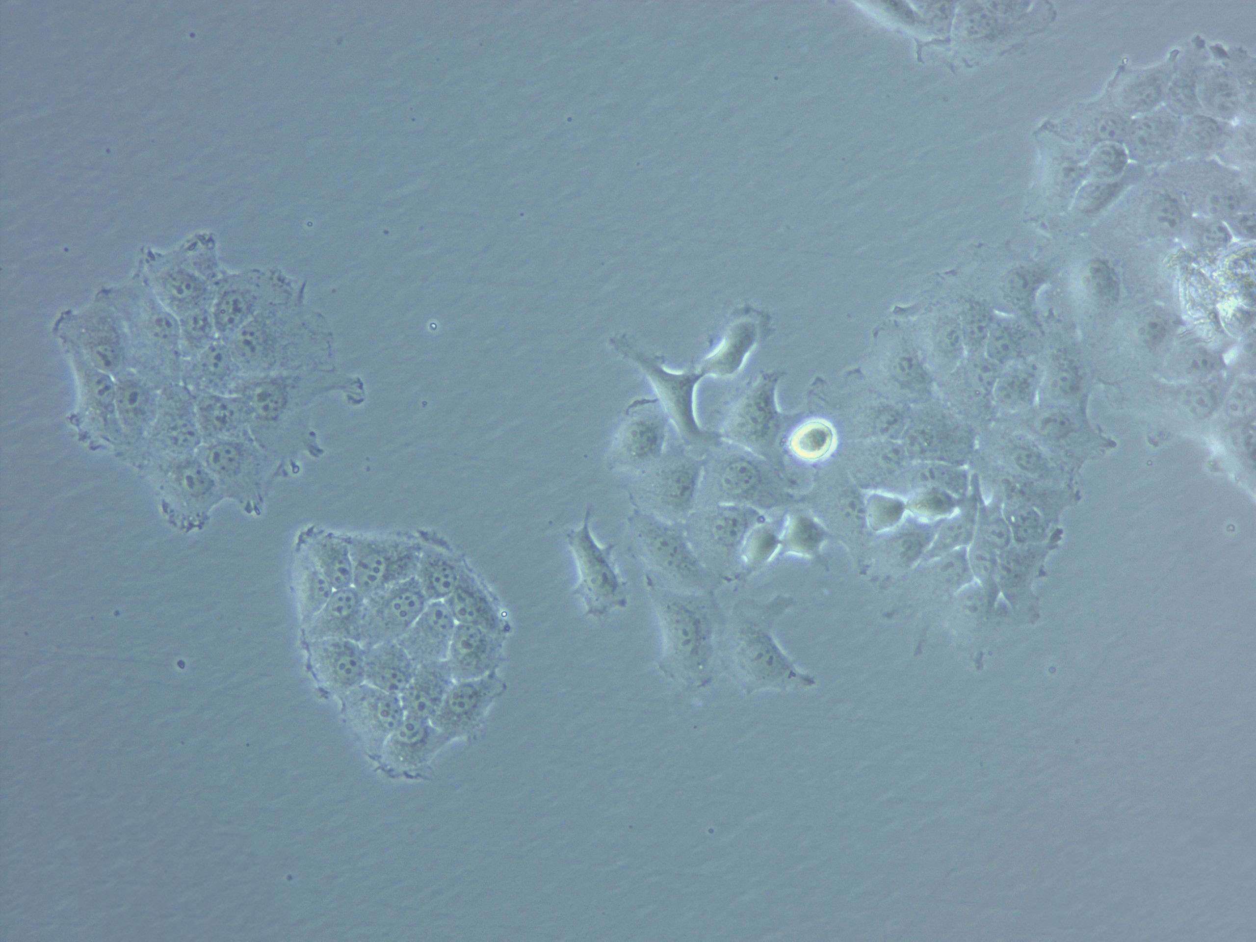 IOSE-80 Cell|人正常卵巢上皮细胞