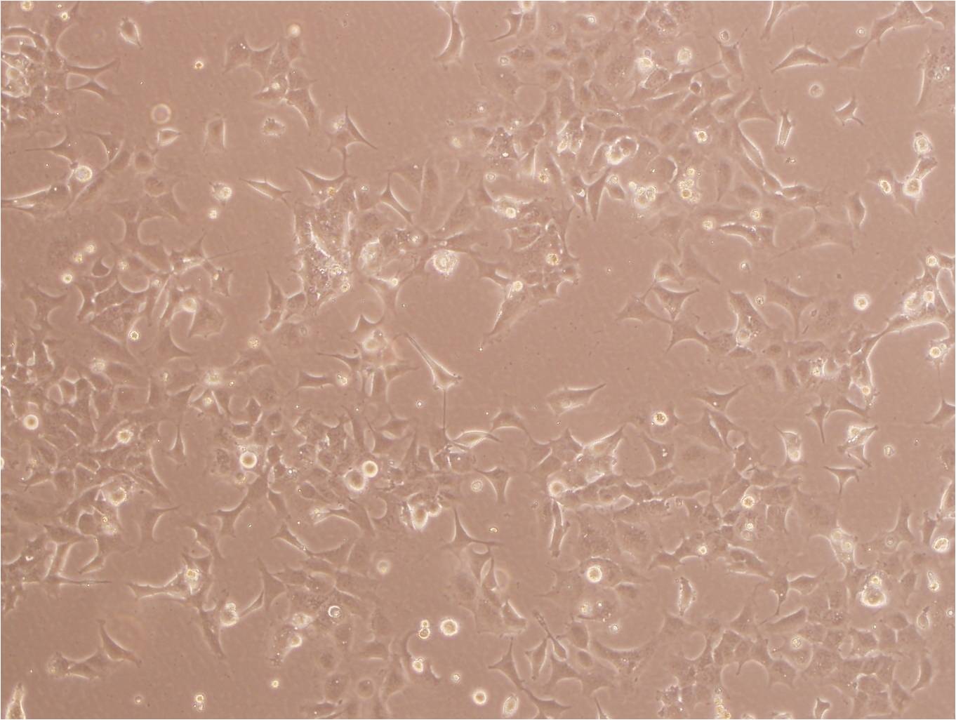 CCD-841CoN:人正常结肠上皮复苏细胞(提供STR鉴定图谱)