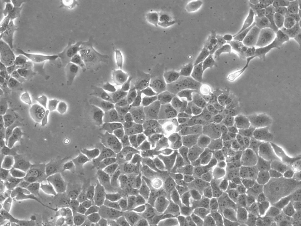 RLE-6TN:大鼠肺泡Ⅱ型复苏细胞(提供STR鉴定图谱)
