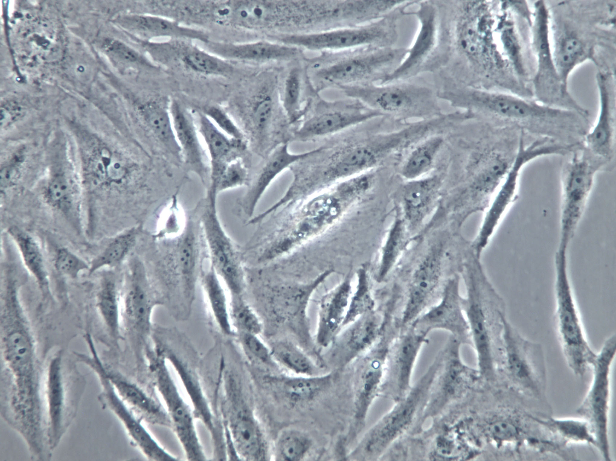 HFLS-RA Cells(赠送Str鉴定报告)|类风湿关节炎成纤维样滑膜细胞
