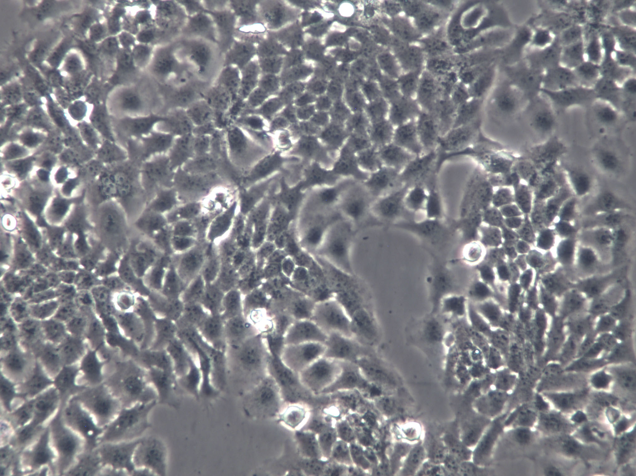 KRC/Y Cells(赠送Str鉴定报告)|人肾癌细胞