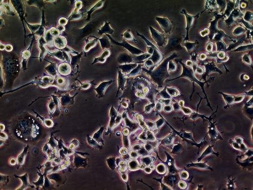PIG1 Cells|正常人皮肤黑色素可传代细胞系