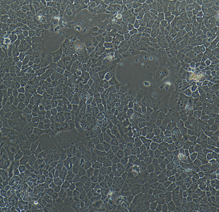 SK-MEL-28人皮肤恶性黑色素瘤细胞