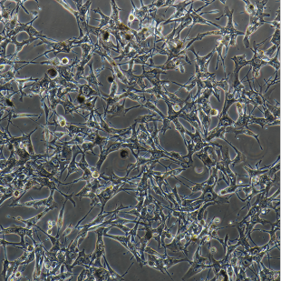 KM-12-SM人结肠病肝转移细胞