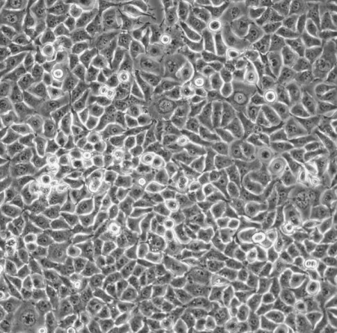 HTR8-SVneo人绒毛膜滋养层细胞