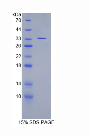 彩斑4-20同源物1抑制因子2(SUV420H2)重组蛋白