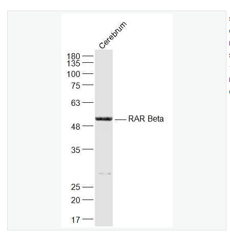 Anti-RARB antibody -维甲酸受体β抗体