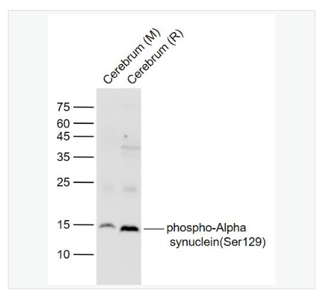 Anti-phospho-Alpha synuclein (Ser129) antibody-磷酸化核突触蛋白α抗体