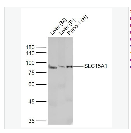 Anti-SLC15A1 antibody  -肠道肽转运蛋白1/小肽转运蛋白1抗体