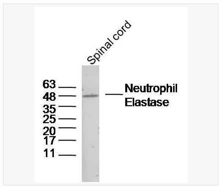 Anti-Neutrophil Elastase antibody-中性粒细胞弹性蛋白酶ELANE抗体