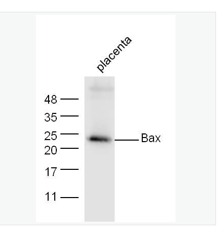 Anti-Bax  antibody-Bax抗体