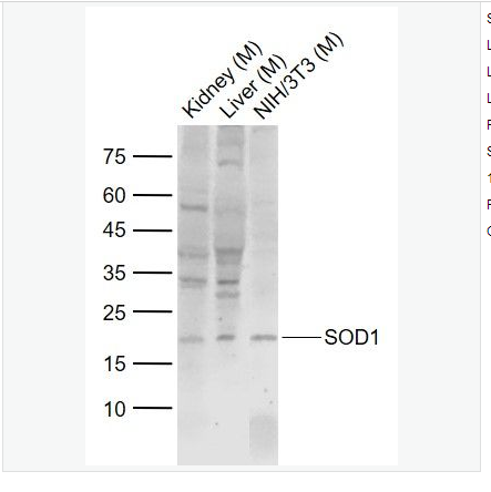 Anti-SOD1 antibody-超氧化物歧化酶1（铜/锌过氧化物歧化酶SOD）抗体