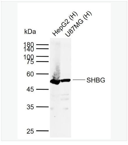 Anti-SHBG antibody-雄激素结合蛋白抗体