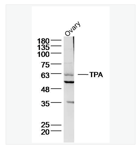 Anti-TPA  antibody-组织型纤溶酶原激活剂抗体