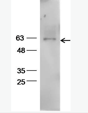 Aromatase 细胞色素P450 19抗体
