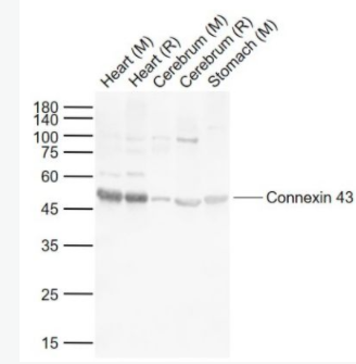 Connexin 43 间隙连接蛋白43抗体