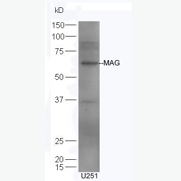 Anti-MAG antibody-髓鞘相关糖蛋白a/b抗体