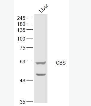 Anti-CBS antibody-丝氨酸羧甲半胱氨酸合成酶抗体