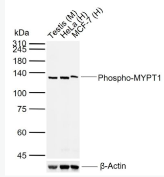 Anti-Phospho-MYPT1 (Thr696) antibody-磷酸化肌球蛋白磷酸酶抗体