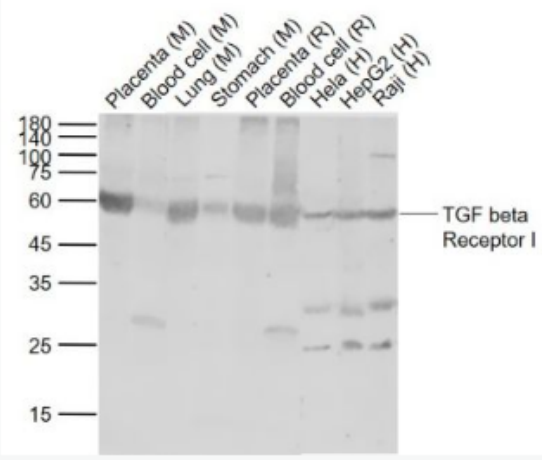 Anti-TGF beta Receptor I antibody-转移生长因子β受体1抗体