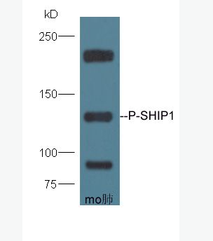 Anti-Phospho-SHIP1 (Tyr1020) antibody-磷酸化SH2结构含磷酸肌醇SHIP1抗体