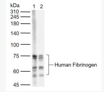 Anti-human Fibrinogen antibody-羊抗人纤维蛋白原抗体