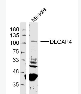 Anti-DLGAP4 antibody-PSD95结合蛋白4抗体