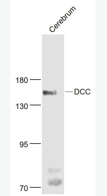 Anti-DCC antibody-结肠直肠癌缺失基因抗体