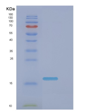 Recombinant E.coli Dnak(385-546) Protein