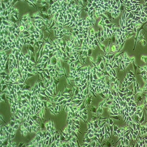 HTR8-Svneo人绒毛膜滋养层细胞