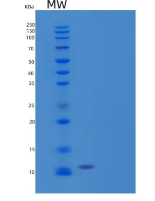 Recombinant Human C-C Motif Chemokine 24/CCL24/Eotaxin-2/MPIF-2 Protein(C-6His)