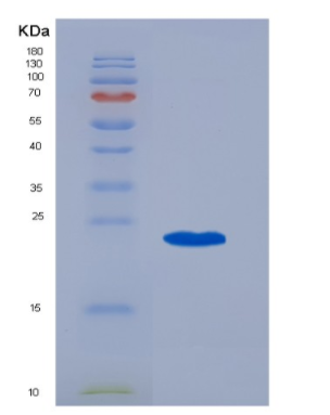 Recombinant Human CD20 / MS4A1 Protein (TrxA Tag)